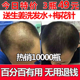 防脱发生发增发密发生发液育发液脂溢性产后脱发水剂快速男女斑秃