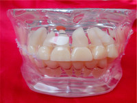 牙科材料 活动牙模型 病理模型 水晶 讲解 沟通 教学 饰品